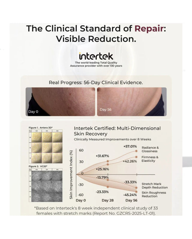 Momcozy Pro-Collagen stangrinamasis pilvo odos kremas, 150 g